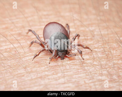 3D-gerenderte Abbildung: die Zecke in die menschliche Haut beißen Stockfoto