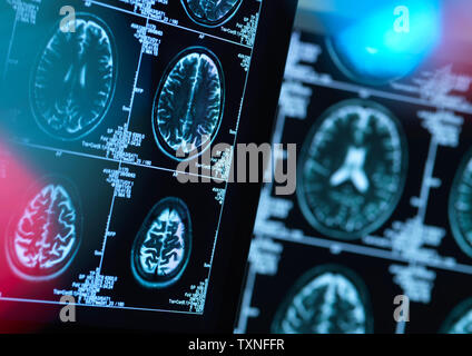 Gehirnscans von möglichen Krankheiten oder Schäden in der Klinik Stockfoto