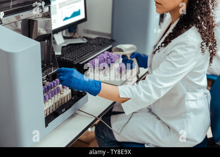 In der Nähe der weiblichen Hand die Blutprobe Stockfoto