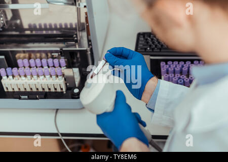 Blick von oben auf eine Blutprobe in männlichen Händen Stockfoto