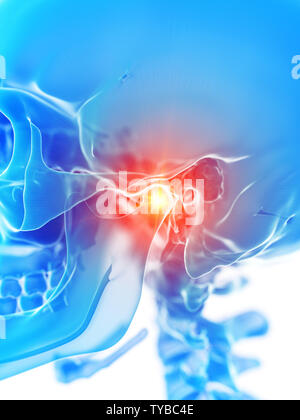 3D-gerenderte medizinisch genauen Abbildung des temporomandibuar Gemeinsame, Schmerzen Stockfoto