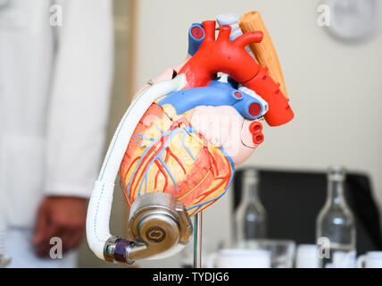 Hannover, Deutschland. 26 Juni, 2019. Eine Heartmate 3 Herzen Support System ist mit einem Herzen Modell befestigt. Credit: Christophe Kirschtorte/dpa/Alamy leben Nachrichten Stockfoto