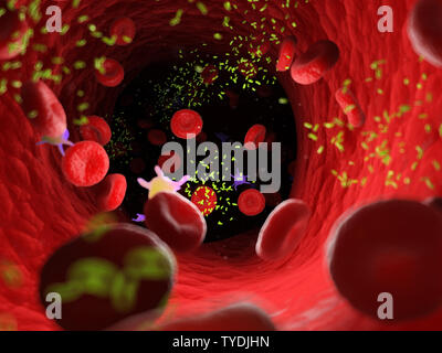 3D-gerenderte Medizinisch genaue Abbildung der Bakterien in einer Arterie Stockfoto