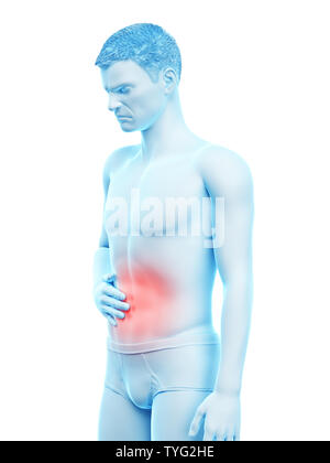 3D-gerenderte Medizinisch genaue Abbildung eines Mans schmerzhafte Magen Stockfoto
