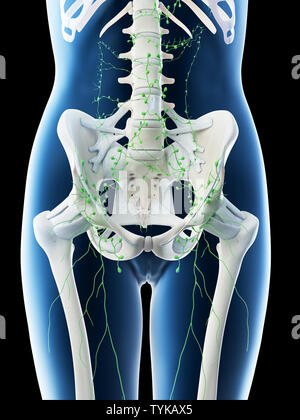 3D-Darstellung von Frauen eine Abdominalen Lymphknoten Stockfoto