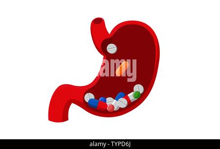 Pillen Tabletten im menschlichen Magen. Einnahme von Medizin oral. Die medizinische Behandlung der Abhängigkeit von Medikamenten Konzept. Vektor Verdauung Orgel flachbild Abbildung Stock Vektor