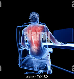 3D-gerenderte Medizinisch genaue Abbildung: Ein Büroangestellter in einem schmerzhaften zurück Stockfoto