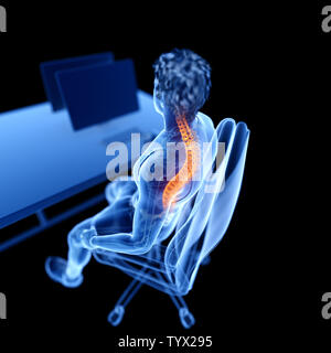 3D-gerenderte Medizinisch genaue Abbildung: Ein Büroangestellter in einem schmerzhaften zurück Stockfoto