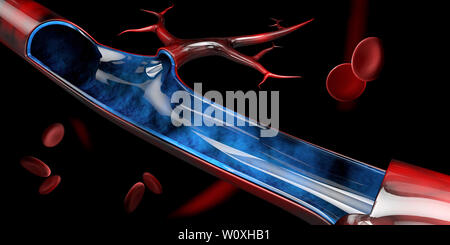 3D-Darstellung von Blut Vene mit roten Blutkörperchen. Stockfoto