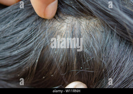 Ruckfahrkamera Bild Auf Dem Kopf