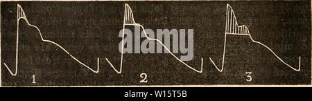 Archiv Bild von Seite 179 Wörterbuch de Physiologie (1907). Wörterbuch de Physiologie. dictionnairedeph 07 reiche Jahr: 1907 Abb. 1. Â Pouls dans la Gi-ossesse (Lounge). Pierre Louge, dans un remarquable Iravail {Le pouls puerpÃral physiologique, D. in Paris, 1886), eine repris la Frage et de ses le exposÃ rÃsultat laborieuses Forschung. Nous lui empruntons La plupart des ÃlÃments de ce Chapitre et reproduisons quelques-uns-de ses tracÃs sphygmographiques. D'Après-ski Pierre Louge, l'Ãtat gravidique Veränd sensiblement les caractÃ¨res De normalen pouls: Il devient plus frÃquent, plus dur et m Stockfoto
