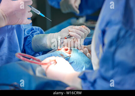 Chirurg und seine Assistentin, die kosmetische Chirurgie an der Nase im Krankenhaus Op. Nase Umgestalten, Augmentation. Rhinoplastik. Stockfoto