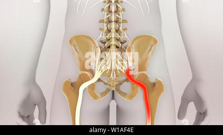 Ischiasnerv Schmerz Stockfoto