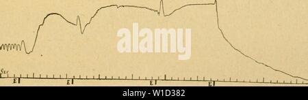 Archiv Bild ab Seite 876 der Wörterbuch de Physiologie (1895). Wörterbuch de Physiologie. dictionnairedeph 00 reiche Jahr: 1895 "Wlfil '-J I I I I Abb. su. - Effets d'iiue Décharge énergique sur la Pression artérielle. Chien de 8 500 Gramm. E, décharge Électrique de 95 Joule. Fici. Vu, - Etiets de décharges jdusieurs énergiques r. Ich |) prucliées. Chienne de 7 Kg. E, décliarges électriques de 77 Joule. coeur Pendant plusieurs entretenant minules, en en même temps La respiration Artifi - cielle, les Kontraktionen des rythmiques ventricules ne se rétablissent Pas. Des décharges Appl Stockfoto
