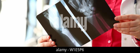 Weibliche Radiologe Halten in der Hand xray Film Stockfoto