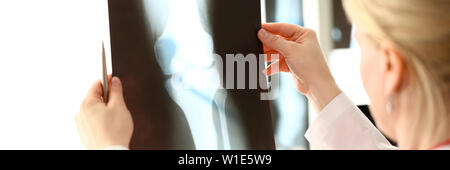 Weibliche radiolog Holding in den Händen x-ray Stockfoto