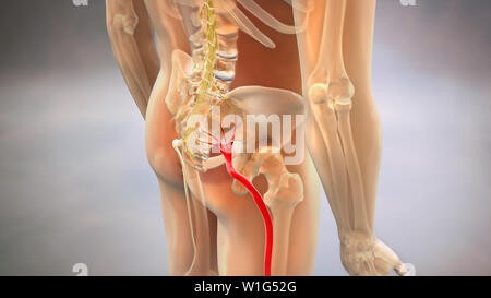 Ischias Nerv eingeklemmt Abbildung Stockfoto
