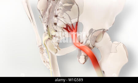 Ischiasnerv Schmerz 3D-Darstellung Stockfoto