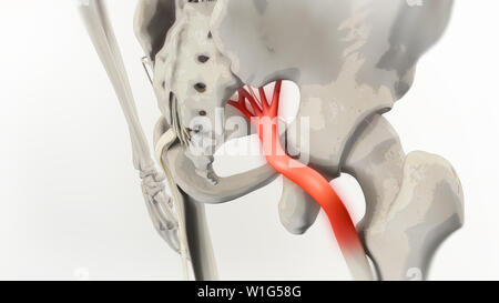 Ischiasnerv Schmerz 3D-Darstellung Stockfoto
