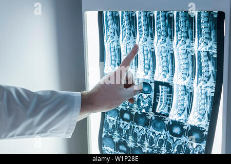 Neurologe und Chirurg untersuchen HWS-Bild eines Patienten Stockfoto