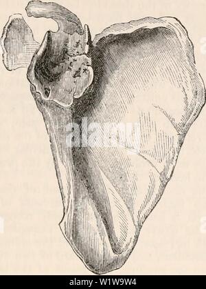 Archiv Bild ab Seite 632 Der cyclopaedia von Anatomie und. Die cyclopaedia von Anatomie und Physiologie cyclopdiaofana 0401 Todd Jahr: 1847 ANORMALE BEDINGUNGEN DES SCHULTERGELENKS. Sembles viel die Probe wird von Herrn Schlüssel angedeutet wird. Die neu geformte Sockel aus Bild erreicht. 438. 611 Dislokation nach vorne und nach unten. (Original, von der Hochschule der Chirurgen, Dublin.) die Kante der GLENOID Hohlraum, auf etwa ein Drittel der gesamten subscapular Fossa; eine tiefe Schale wurde für den Empfang der verschobene Leiter der htimerus gebildet; der innere Rand der Tasse war voll eine halbe Zoll ab Stockfoto