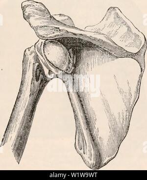 Archiv Bild ab Seite 632 Der cyclopaedia von Anatomie und. Die cyclopaedia von Anatomie und Physiologie cyclopdiaofana 0401 Todd Jahr: 1847 Dislokation nach vorne und nach unten. (Original, von der Hochschule der Chirurgen, Dublin.) die Kante der GLENOID Hohlraum, auf etwa ein Drittel der gesamten subscapular Fossa; eine tiefe Schale wurde für den Empfang der verschobene Leiter der htimerus gebildet; der innere Rand der Tasse war voll eine halbe Zoll über dem Niveau des subscapular; Fossa glenoides Hohlraum hatte alle Knorpeligen Investitionen verloren; es war hart auf der Oberfläche von Knöchernen depositio Stockfoto