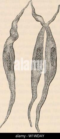 Archiv Bild ab Seite 725 Der cyclopaedia von Anatomie und. Die cyclopaedia von Anatomie und Physiologie cyclopdiaofana 05 Todd Jahr: 1859 650 GEBÄRMUTTER UND IHRE ANHÄNGSEL. Zustand. Diese, bis zu der Zeit der impregna-tion, bilden die besonderen und alleinigen Elemente des Muskelgewebes; doch einige Physiologen selbst der Gegenwart verweigern in diesen einen muskulösen Charakter zu erkennen, obwohl es klar ist, dass die Gebärmutter so gebaut hat eine kontraktile Kraft. Das Auftreten von ab-ortion, manchmal ganz am Anfang der Schwangerschaft, die Ausweisung von polypi und dys-menorrhceal Membranen, und der painfu Stockfoto