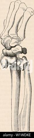 Archiv Bild ab Seite 737 Der cyclopaedia von Anatomie und. Die cyclopaedia von Anatomie und Physiologie cyclopdiaofana 0402 Todd Jahr: 1849 die Verknüpfung der Epiphyse des Radius, mit Verschiebung nach hinten von der Hand und Carpus, - Sammlung Autor. Superadded wurde auf den Gipfel des karpus, und wurde wieder vorgenommen, das Handgelenk - Gemeinsame selbst perfekt. Dieser einfache Test der vergleichenden Messung erwies sich der Fall war nicht eine bloße Verlagerung von der Hand; aber wir können auch hinzufügen, daß, obwohl es erhebliche Schwellung und Projektion nach vorne Der palmar Surf war Stockfoto