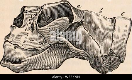 Archiv Bild von Seite 171 des cyclopaedia von Anatomie und. Die cyclopaedia von Anatomie und Physiologie cyclopdiaofana 0402 Todd Jahr: 1849 Diese missgeburt, fg. 611. Durch die Struktur der Schädel. Abb. 61 J. ein, frontale; b, Parietalen, Okzipitalen; c, Knochen. In vielen der veröffentlichten Beobachtungen, eine Ansammlung seröser Flüssigkeit begleitet die Hernie cerebri, durch die eine hydro-encephaloccfe wurde gebildet. Die Situation der zerebralen Hernie ist im Allgemeinen auf dem Hinterhauptbein, aber manchmal auf beiden Seiten der Wurzel der Nase (W. Lyon, Kelch); oben das Auge (Adams); auf der Stirn (Beclard, Saxtorph, Niemeye Stockfoto