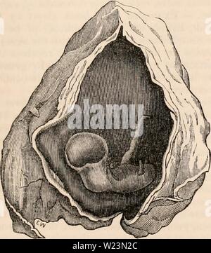 Archiv Bild von Seite 174 des cyclopaedia von Anatomie und. Die cyclopaedia von Anatomie und Physiologie cyclopdiaofana 0402 Todd Jahr: 1849 Bärchen ein neues -lorn Lamm mit Cyclopla. a, a, medulläres Erweiterung mit seröser Flüssigkeit gefüllt; b, Sehnerv, e, c, Stiel des Gehirns; d, Pons Varolii; e, Medulla oblongata;/'/', Kleinhirn; g, Rückenmark medulla; 3, 4, 5, 6, 7, 8, 9, 10, 11, 12, der Hirnnerven, bestehende Neben den Sehnerv. Beobachtet (G. Vrolik, rudolphi). Siehe Abb. 615. Abb. G 15. (Geändert von rudolphi von W. Vrolik.) menschliche Eizelle, icilh ein Embryo von tiro Monate, affecte Stockfoto