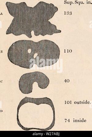 Archiv Bild ab Seite 257 Der cyclopaedia von Anatomie und. Die cyclopaedia von Anatomie und Physiologie cyclopdiaofana 0402 Todd Jahr: 1849 1042 THORAX. Interne Messungen (kubische oder Durchmesser) eindeutig in keinem Verhältnis zu der Höhe und Gewicht der Mann, während die Vitalkapazität tut dies in einem genauen Verhältnis. Wenn wir eine Besetzung der Brusthöhle nehmen und die Grundansicht, präsentiert es die Form der Zahlen im Diagramm 'Abb. 669. Die eine Messung bedeuten, in der Männer von 40-sechs, und bei Frauen in Fünfunddreißig, oberflächliche Zoll. In der Grafik (von Skala reduziert), Wir kleben die Höhe jeder Cas Stockfoto