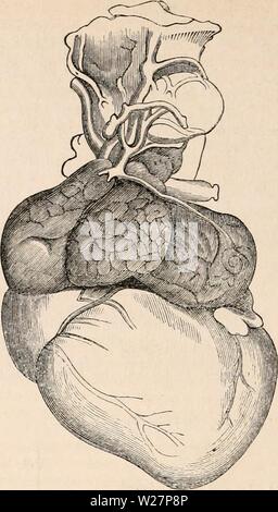 Archiv Bild ab Seite 303 Der cyclopaedia von Anatomie und Stockfoto