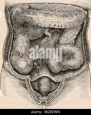 Archiv Bild ab Seite 437 Der cyclopaedia von Anatomie und Stockfoto