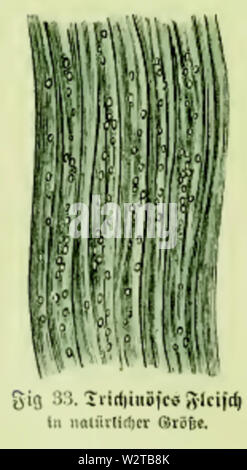 Die Frau als Hausärztin (1911) 033 Trichinöses Fleisch Stockfoto