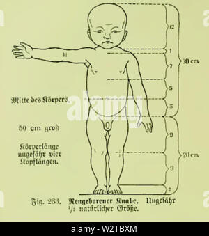 Die Frau als Hausärztin (1911) 233 Neugeborener Knabe Stockfoto