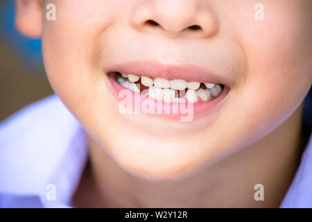 Baby Zähne sind nur in den Mund und Zahn regenerieren. Stockfoto