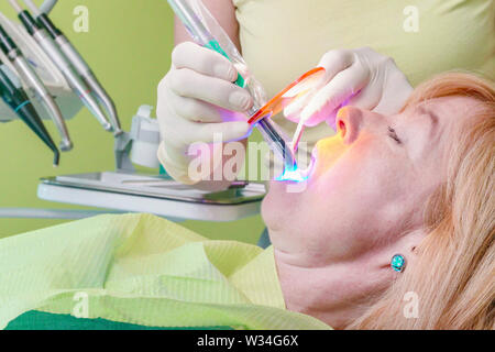 Ein in der Hand gehaltenes Wand strahlt, dass Primäre blaues Licht verwendet wird das Harz in eine zahnmedizinische Patienten öffnung zu kurieren. Stockfoto