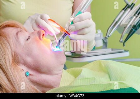 Ein in der Hand gehaltenes Wand strahlt, dass Primäre blaues Licht verwendet wird das Harz in eine zahnmedizinische Patienten öffnung zu kurieren. Eine zahnmedizinische Polymerisationslampe Ausrüstung Stockfoto