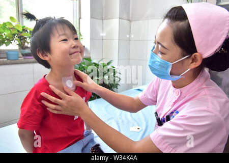 (190712) - SHIJIAZHUANG, Juli 12, 2019 (Xinhua) - ein Mädchen erhält sanfutie Behandlung in Shijiazhuang, nördlich der chinesischen Provinz Hebei, 12. Juli 2019. Freitag, markiert den Beginn der sanfu, die zu den drei 10-tägigen Perioden, die prognostiziert werden die heißesten Tage des Jahres zu sein, bezieht. Sanfutie, einem typischen Counter - Jahreszeit Behandlung im System der Traditionellen Chinesischen Medizin, behandelt Kälte - Wetter - in Verbindung stehende Krankheiten im heißen Sommer mit einem Verband aus traditionellen chinesischen Kräutermedizin auf verschiedenen Akupunkturpunkte am Körper platziert. (Foto von Jia Minjie/Xinhua) Stockfoto