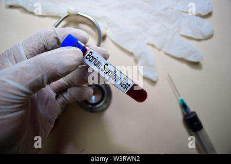 Barium schlucken Test text auf Haftnotizen. Draufsicht auf Büro Schreibtisch isoliert. Healthcare/Medical Konzept Stockfoto