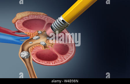 Nierenstein Ausbau medizinisches Konzept als Organ mit schmerzhaften mineral Formationen als Medizin Symbol mit einem Querschnitt mit 3D-Darstellung. Stockfoto