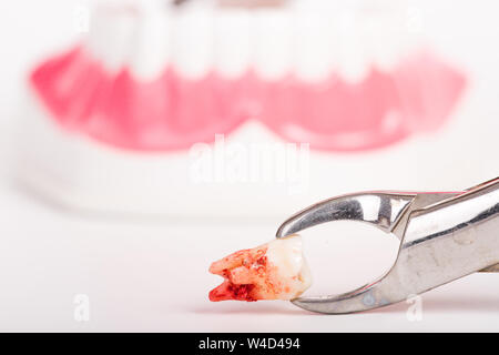 Zahnmedizinische Instrumente und Zahn an der Klinik entfernen auf Weiß isoliert Stockfoto