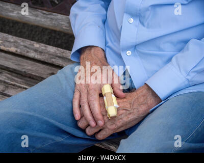 Mans hand mit einem improvisierten Schiene auf Finger. Tun Sie es sich Erste Hilfe. Stockfoto