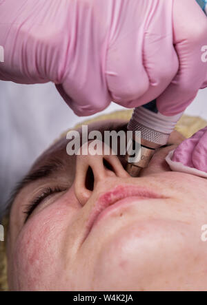 Junge Frau mit Problemhaut, mechanische Reinigung. kosmetikerin Haut der Frau mit kosmetischen Geräten reinigt. Stockfoto