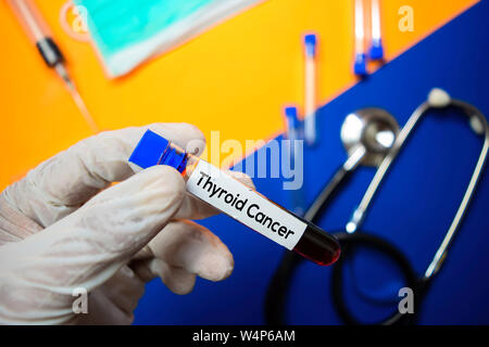 Schilddrüsenkrebs mit Blutprobe. Ansicht von oben auf die Farbe Hintergrund isoliert. Healthcare/Medical Konzept Stockfoto