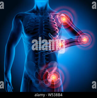 Mann männliche Körper mit schmerzhaften Gelenken - 3D-Darstellung Stockfoto