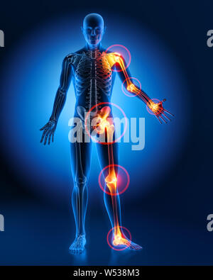 Mann männliche Körper mit schmerzhaften Gelenken - 3D-Darstellung Stockfoto