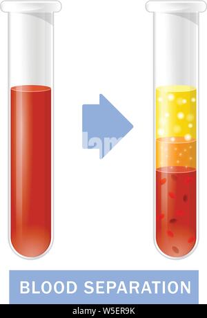 Reagenzglas mit Blut nach der Trennung von Thrombozyten, PRP Infografiken, platelet-rich Plasma Stock Vektor