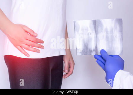 Arzt hält x-ray Bild auf dem Hintergrund eines Mädchens mit Schmerzen im Hüftgelenk und Bandscheiben Bandscheibenvorfall, Fibromyalgie, - Hautnah, Ultraschalldiagnostik Stockfoto