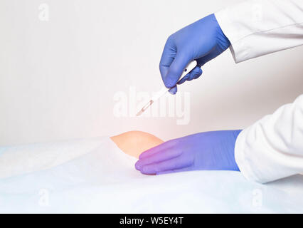 Arzt Chirurg mit einem Skalpell in der Hand macht einen Schnitt im Kniegelenk. Konzept der gemeinsamen Austausch, Ersatz des Kniegelenkes mit einer Kunst Stockfoto